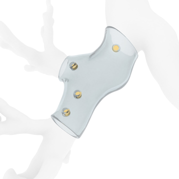 Stent trachéo-bronchique 3D