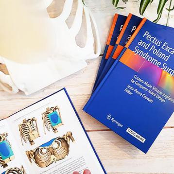 Publication Springer 2019 Pectus Excavatum et Syndrome de Poland Publication Springer 2019 Pectus Excavatum et Syndrome de Poland