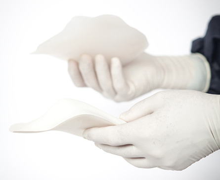 AnatomikModeling, impianti chirurgici 3D - 3Dnatives